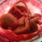 fetus