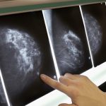 mamografi-1
