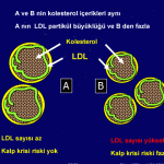 ldl